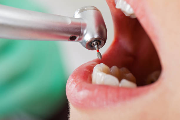 Fast & Reliable Emergency Dental Services in ND